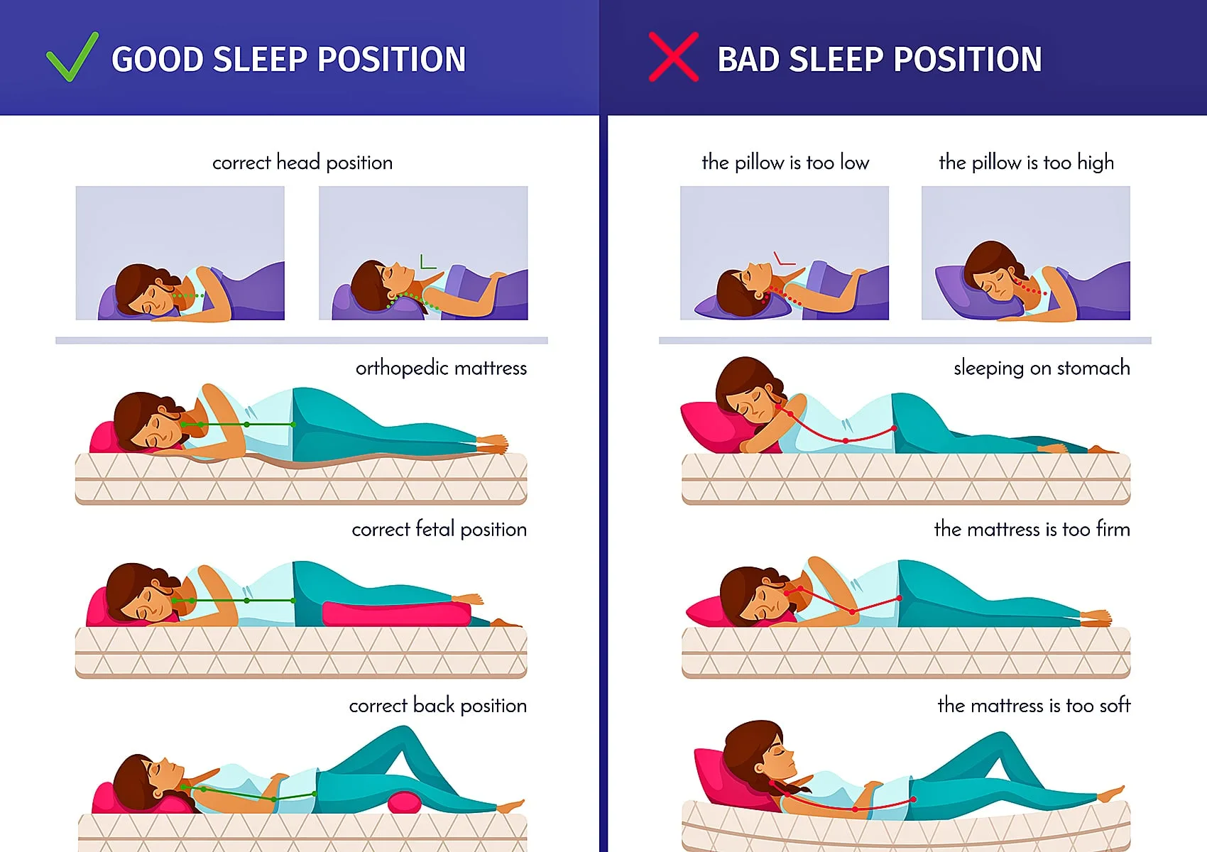 Poor Mattress and Sleeping Position causes Back Pain